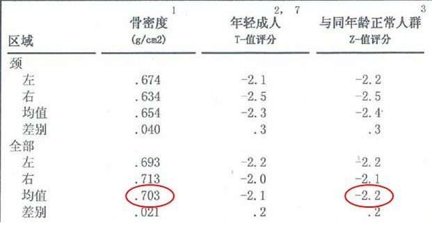 91视频下载免费仪生产厂家根据T值和Z值的变化来判断骨骼健康的状况 91视频下载免费仪生产厂家根据T值和Z值的变化来判断骨骼健康的状况